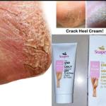 Cracked Heel Cream.