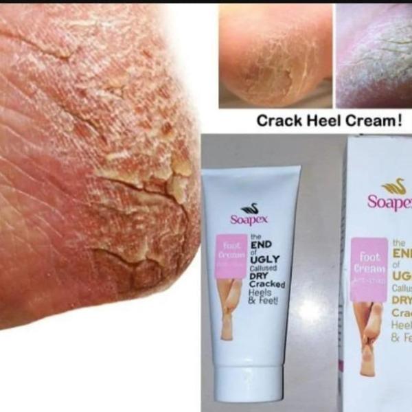 Cracked Heel Cream.